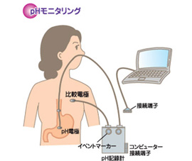 pHモニタリング